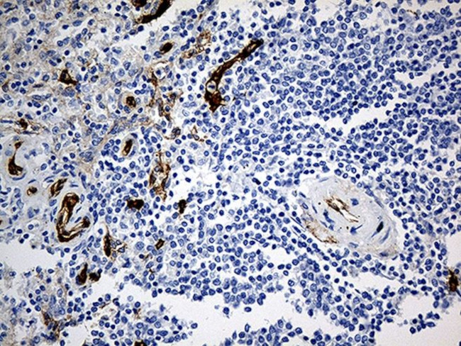 CD34 Antibody in Immunohistochemistry (Paraffin) (IHC (P))