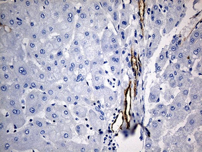 CD34 Antibody in Immunohistochemistry (Paraffin) (IHC (P))