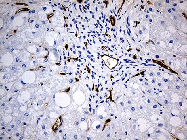 CD34 Antibody in Immunohistochemistry (Paraffin) (IHC (P))