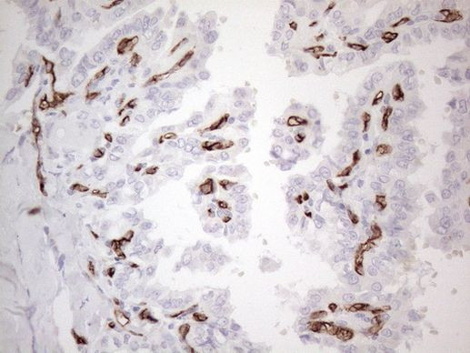 CD34 Antibody in Immunohistochemistry (Paraffin) (IHC (P))