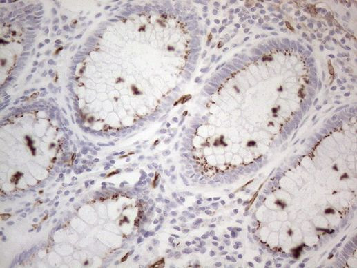 CD34 Antibody in Immunohistochemistry (Paraffin) (IHC (P))