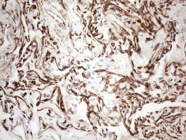 CD34 Antibody in Immunohistochemistry (Paraffin) (IHC (P))