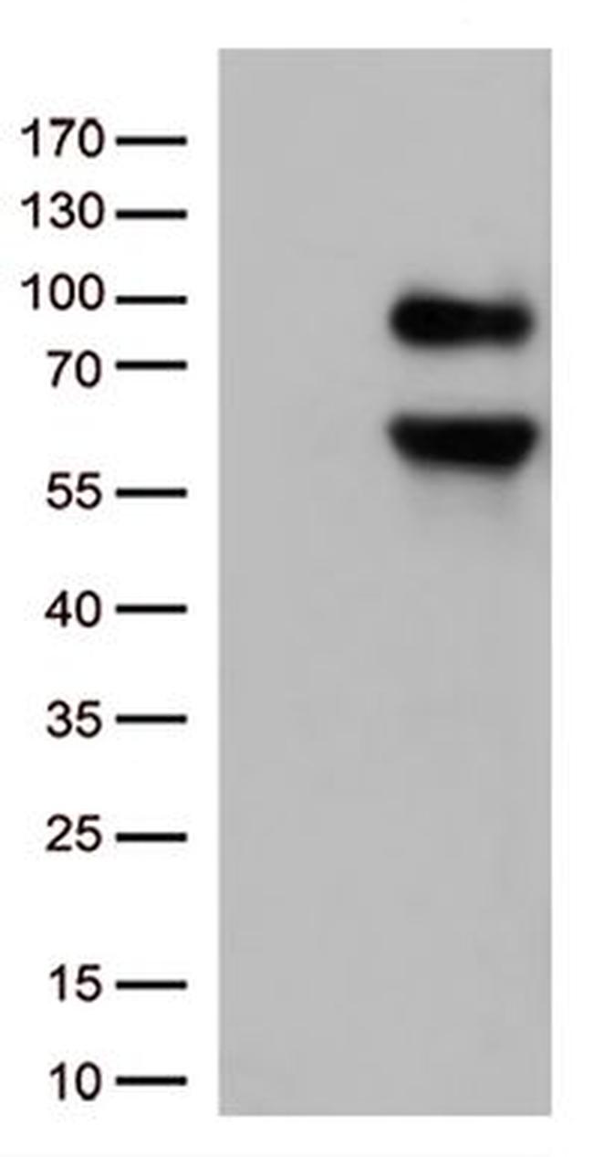 CD36 Antibody in Western Blot (WB)