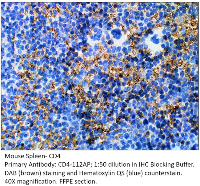 CD4 Antibody in Immunohistochemistry (IHC)