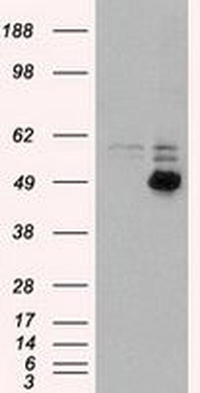 CD4 Antibody in Western Blot (WB)