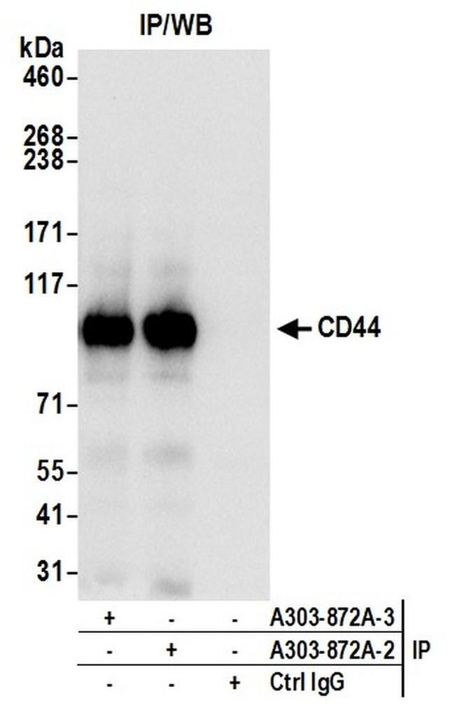 CD44 Antibody in Western Blot (WB)