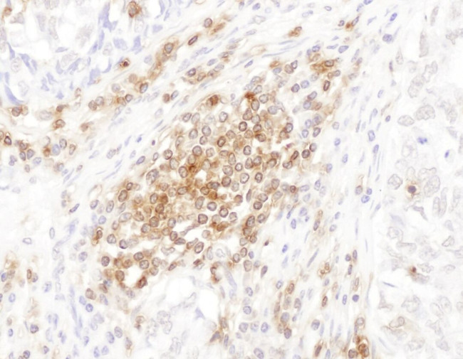 CD45 Antibody in Immunohistochemistry (IHC)