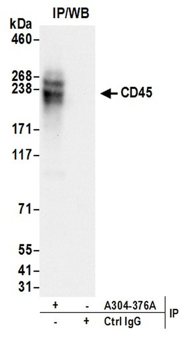 CD45 Antibody in Western Blot (WB)