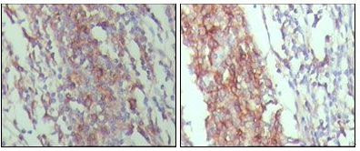 CD45 Antibody in Immunohistochemistry (Paraffin) (IHC (P))