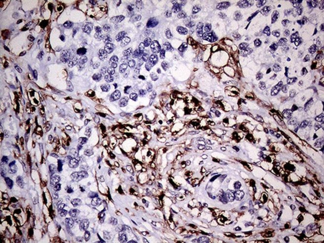 CD45RO Antibody in Immunohistochemistry (Paraffin) (IHC (P))