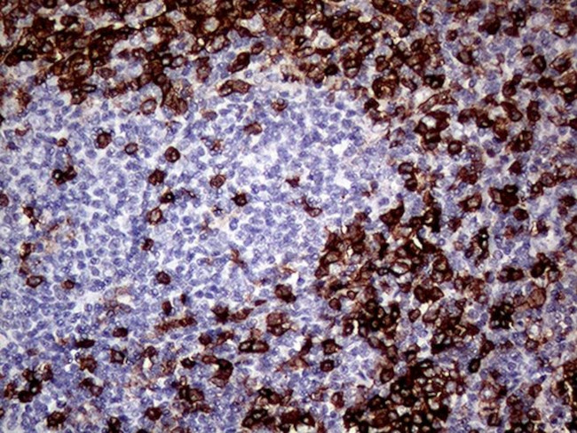 CD45RO Antibody in Immunohistochemistry (Paraffin) (IHC (P))