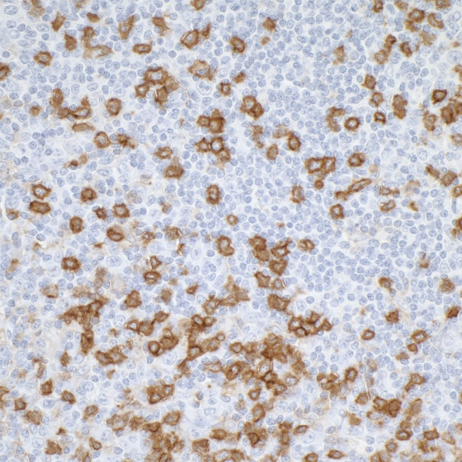 CD45RO Antibody in Immunohistochemistry (Paraffin) (IHC (P))