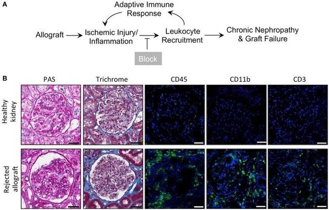 CD45 Antibody in Immunohistochemistry (IHC)