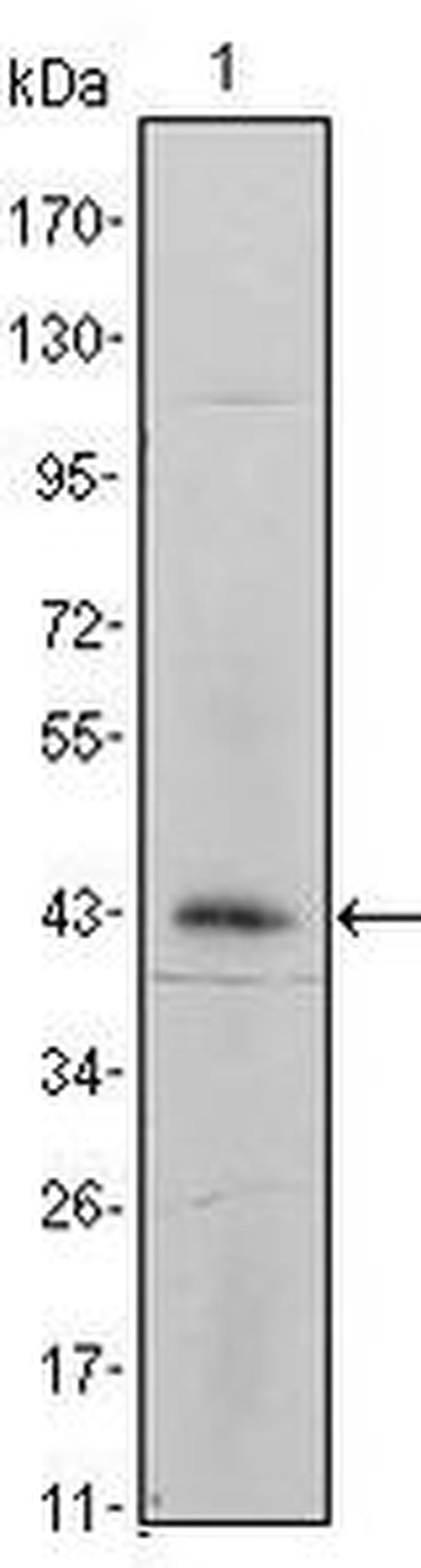 ITGA5 Antibody in Western Blot (WB)