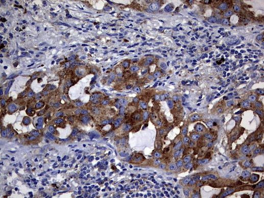 CD63 Antibody in Immunohistochemistry (Paraffin) (IHC (P))