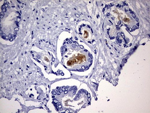 CD63 Antibody in Immunohistochemistry (Paraffin) (IHC (P))