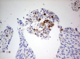 CD68 Antibody in Immunohistochemistry (Paraffin) (IHC (P))