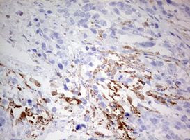 CD68 Antibody in Immunohistochemistry (Paraffin) (IHC (P))