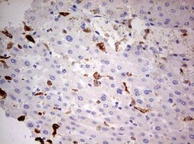 CD68 Antibody in Immunohistochemistry (Paraffin) (IHC (P))