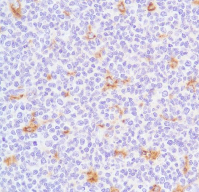 CD68 Antibody in Immunohistochemistry (Paraffin) (IHC (P))