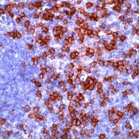 CD8 Antibody in Immunohistochemistry (Paraffin) (IHC (P))