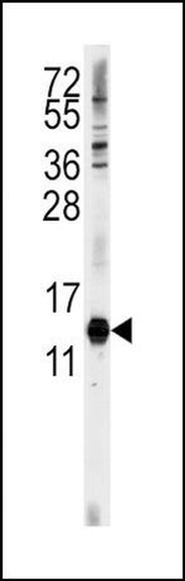 CDA Antibody in Western Blot (WB)