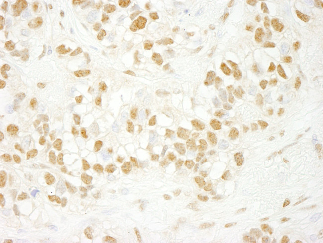 CDC5L Antibody in Immunohistochemistry (IHC)