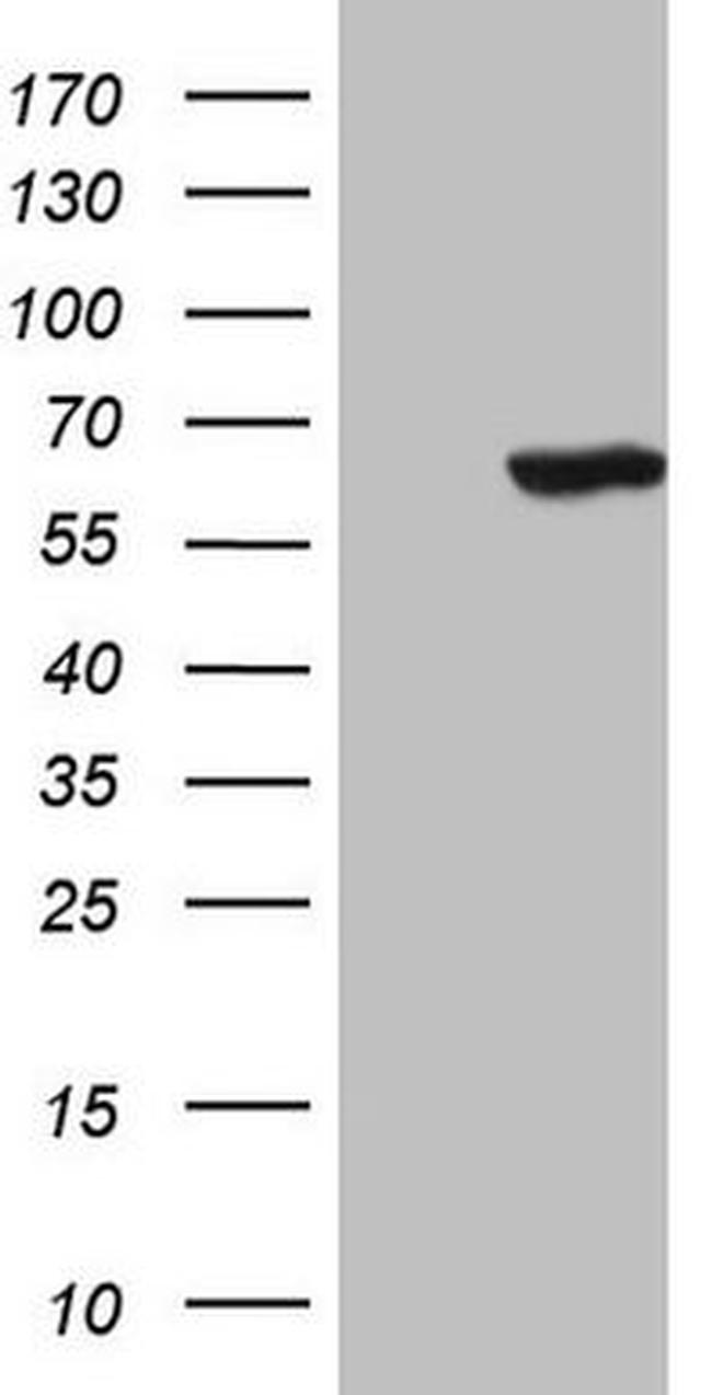 CDC6 Antibody in Western Blot (WB)