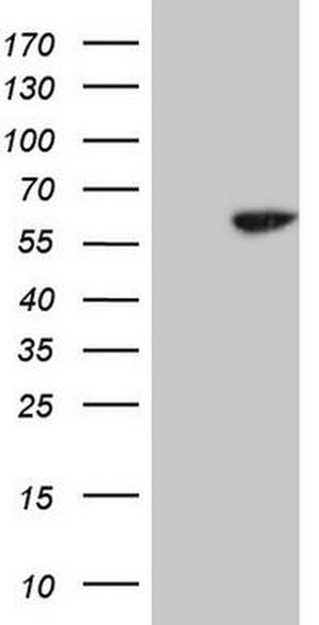 CDC6 Antibody in Western Blot (WB)