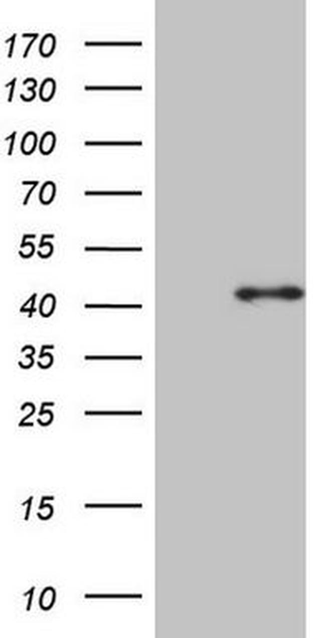 CDCA8 Antibody in Western Blot (WB)