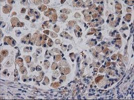 CDCP1 Antibody in Immunohistochemistry (Paraffin) (IHC (P))