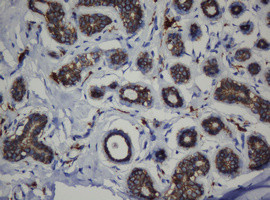 CDH1 Antibody in Immunohistochemistry (Paraffin) (IHC (P))