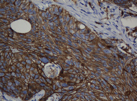 CDH1 Antibody in Immunohistochemistry (Paraffin) (IHC (P))