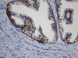 CDH1 Antibody in Immunohistochemistry (Paraffin) (IHC (P))