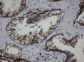 CDH1 Antibody in Immunohistochemistry (Paraffin) (IHC (P))