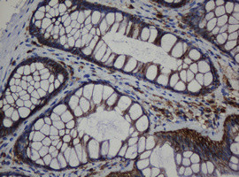 CDH1 Antibody in Immunohistochemistry (Paraffin) (IHC (P))