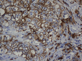 CDH1 Antibody in Immunohistochemistry (Paraffin) (IHC (P))