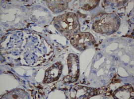 CDH1 Antibody in Immunohistochemistry (Paraffin) (IHC (P))