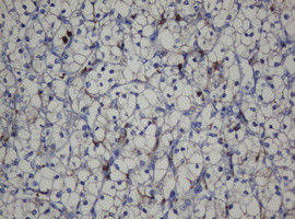 CDH1 Antibody in Immunohistochemistry (Paraffin) (IHC (P))