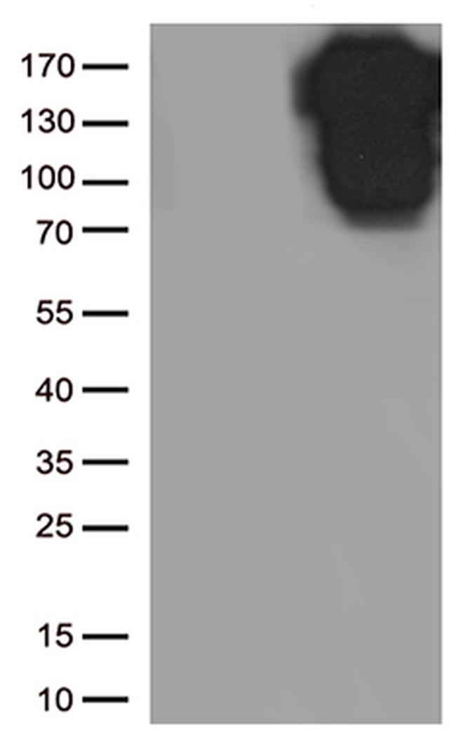 CDH1 Antibody in Western Blot (WB)