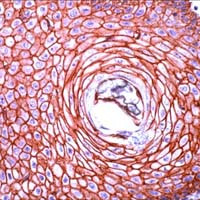 N-cadherin Antibody in Immunohistochemistry (IHC)