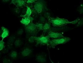 CDK2 Antibody in Immunocytochemistry (ICC/IF)