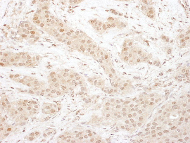 CDK4 Antibody in Immunohistochemistry (IHC)