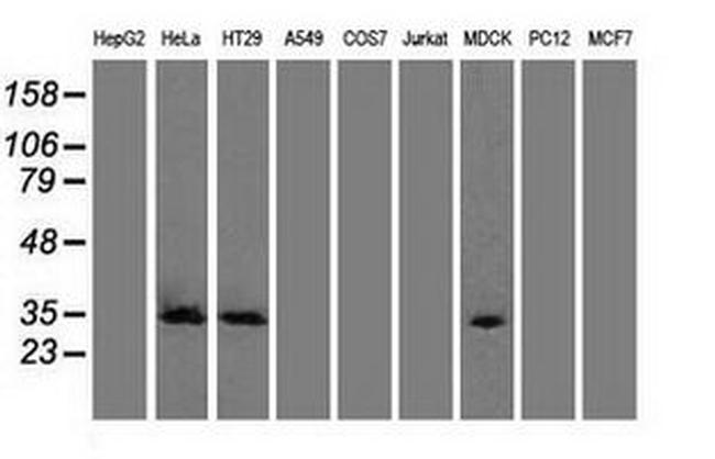 CDK5 Antibody in Western Blot (WB)