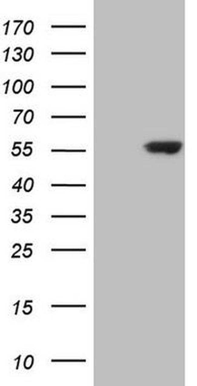 CDKL2 Antibody in Western Blot (WB)