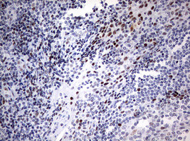 CDKN2A (p14ARF/p19ARF) Antibody in Immunohistochemistry (Paraffin) (IHC (P))