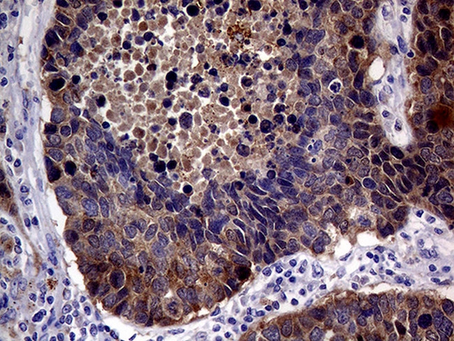 CDKN2A Antibody in Immunohistochemistry (Paraffin) (IHC (P))