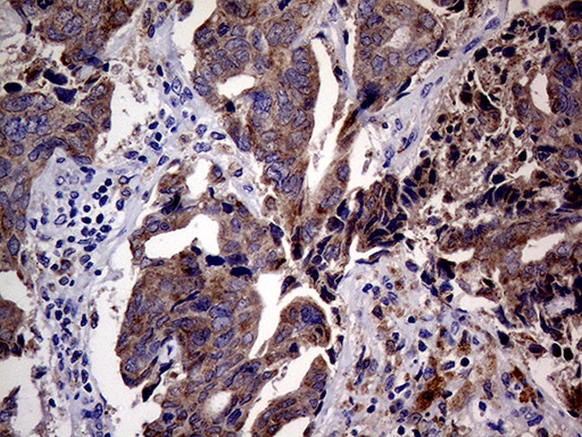 CDKN2A Antibody in Immunohistochemistry (Paraffin) (IHC (P))