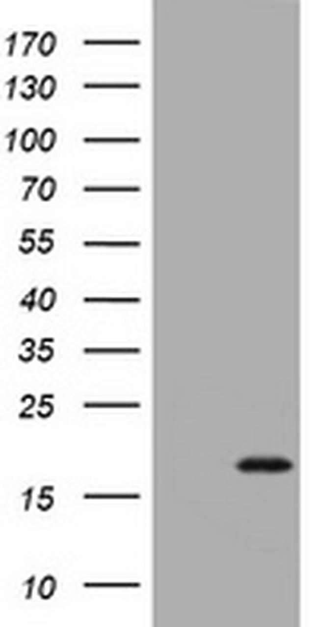 CDKN2A (p14ARF/p19ARF) Antibody in Western Blot (WB)