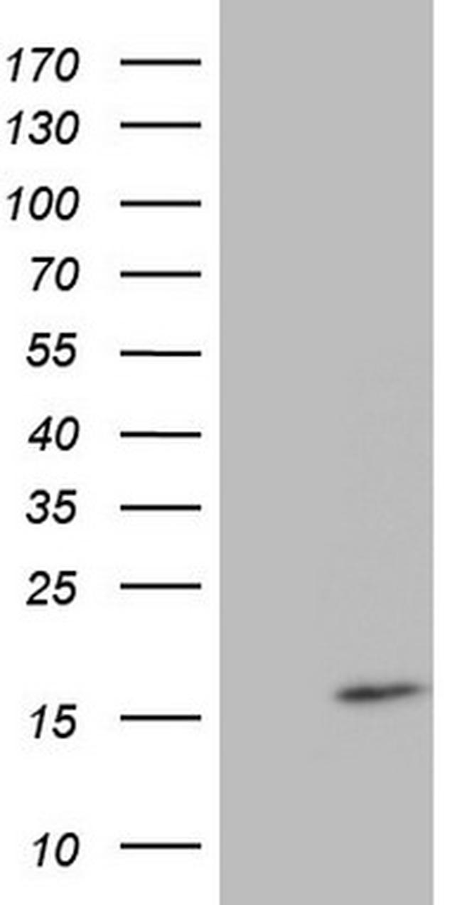 CDKN2A (p16INK4a) Antibody in Western Blot (WB)